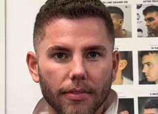 Dean McCullough’s $1000+ Hair Transplant Before Joining I’m A Celeb news-21112024-063320